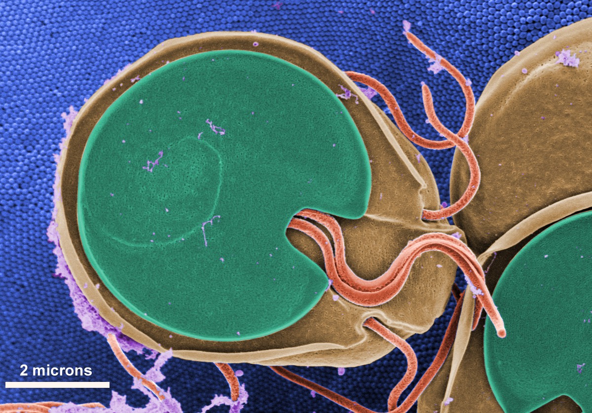 Colored scanning electron microscope image of a parasitic microorganism (green) interacting with a host cell (brown) and thread-like structures (red), illustrating parasite evolution; scale shows 2 microns; blue, textured background.