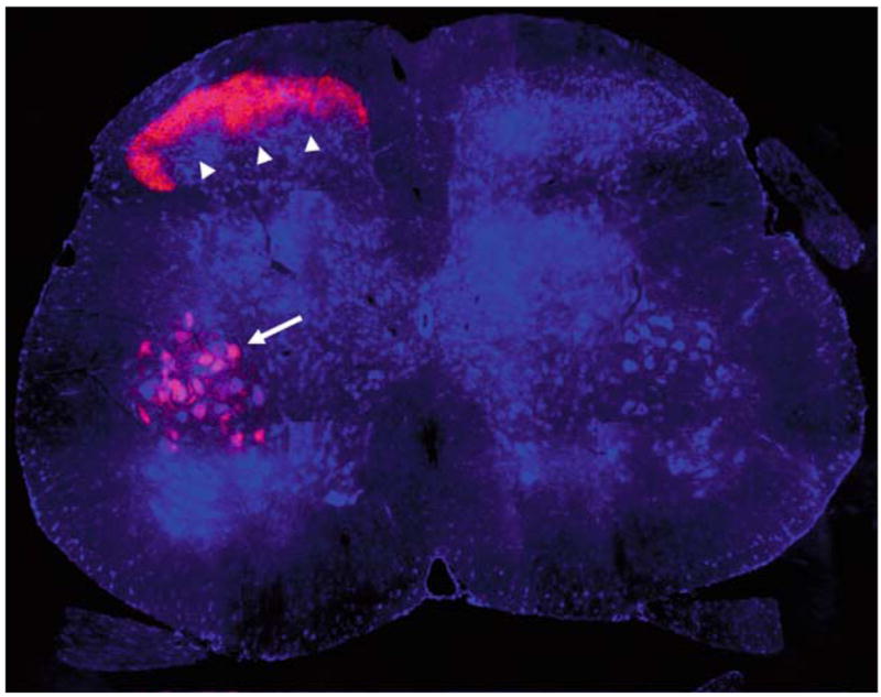 Fluorescent microscopy image of a mouse spinal cord cross-section; areas in red indicate activated neurons, highlighted by an arrow and arrowheads, while Mammalian CNS axons and surrounding tissue appear in shades of blue.
