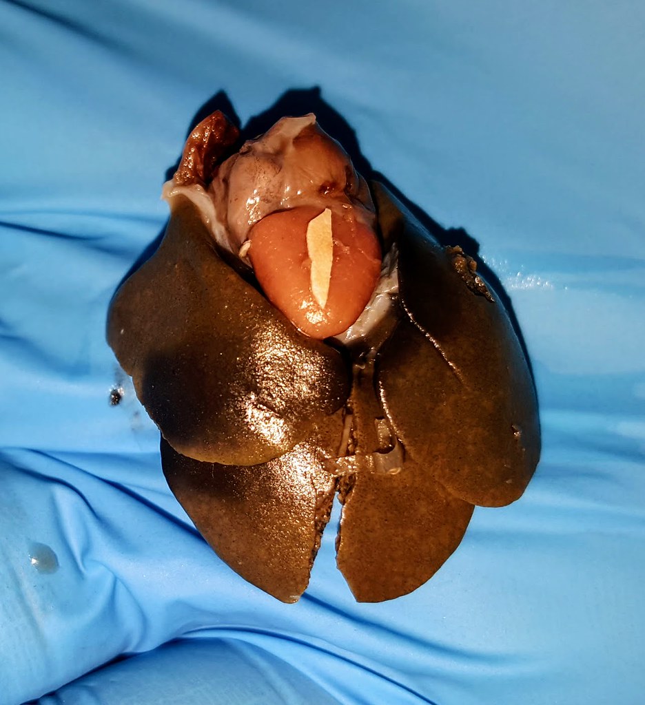 A gloved hand holds a partially opened, shiny brown seed pod revealing a tan-colored seed inside, often studied for its potential impact on liver dysfunction.