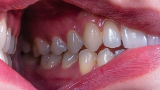a person's mouth with teeth showing