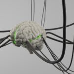 A computer generated image of a brain surrounded by wires