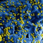 yellow flower petals on blue textile