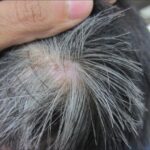 Can Gray Hair Be Reversed?
