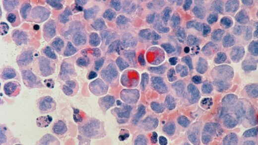 red round fruits on white and blue surface