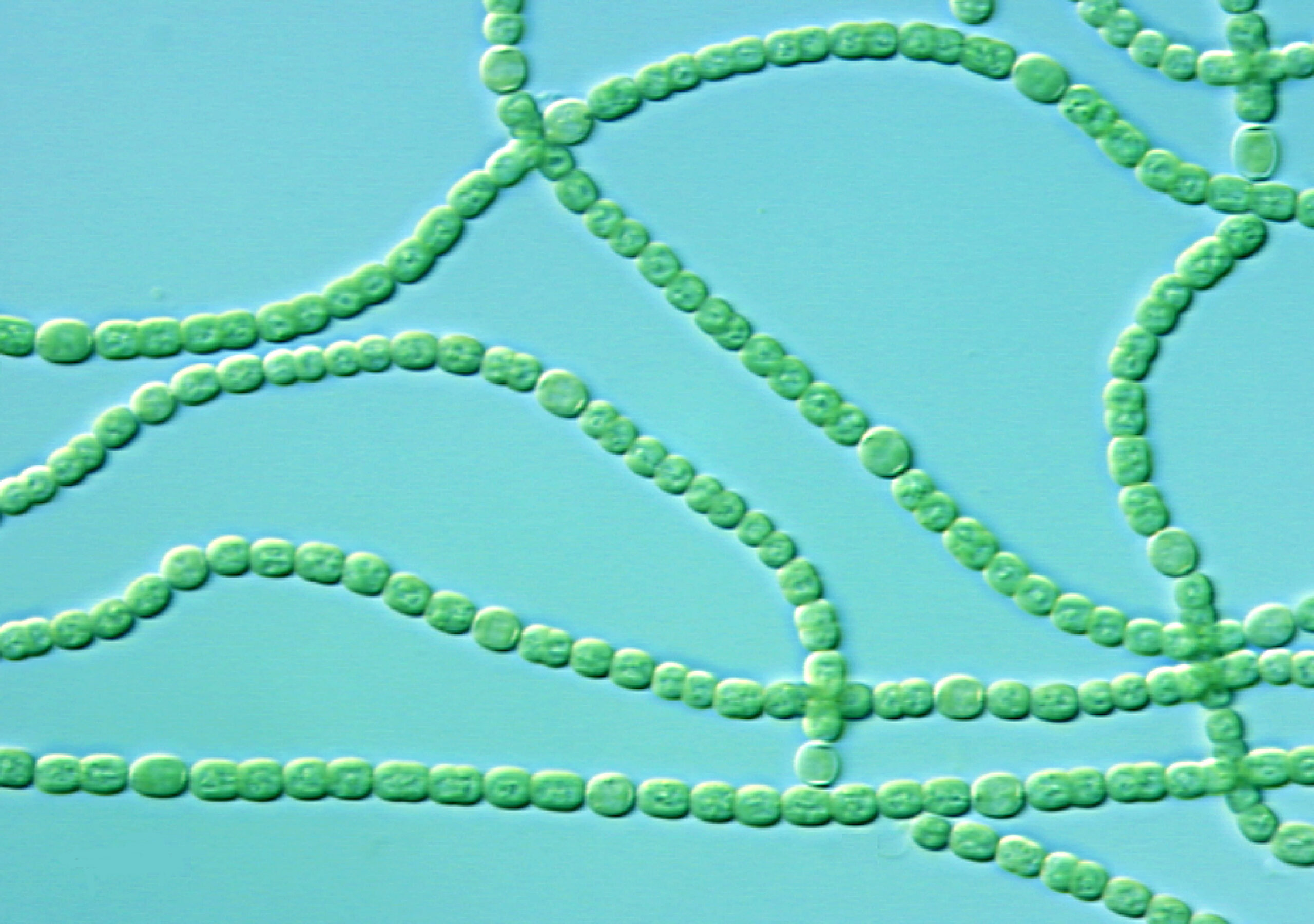 Close-up image of green, bead-like chains of cyanobacteria—bacteria that can turn plant waste into green energy—seen under a microscope against a light blue background. The round cells connect, forming long, curving filaments.