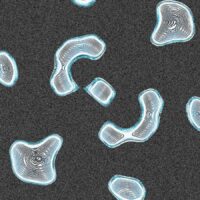 microplastics-in-bones