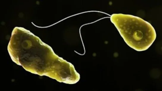 amoeba-brain-eating