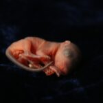 Fetal Microchimerism