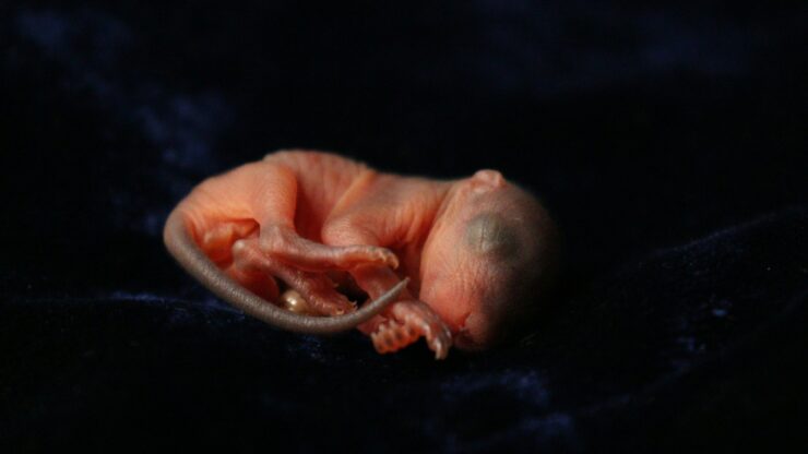 Fetal Microchimerism