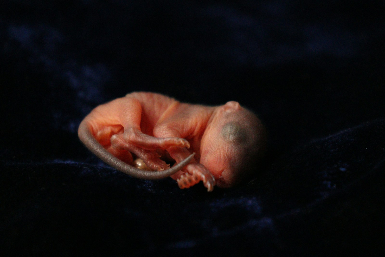 Fetal Microchimerism