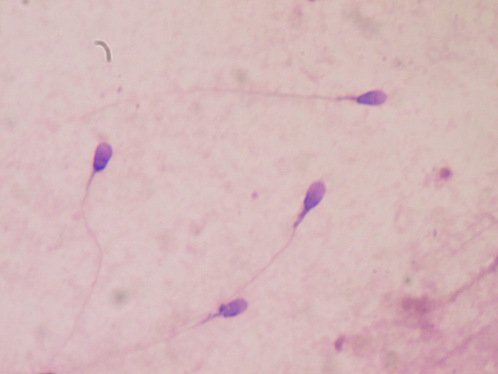 Scientists Caught Sperm Ignoring a Major Physical Law