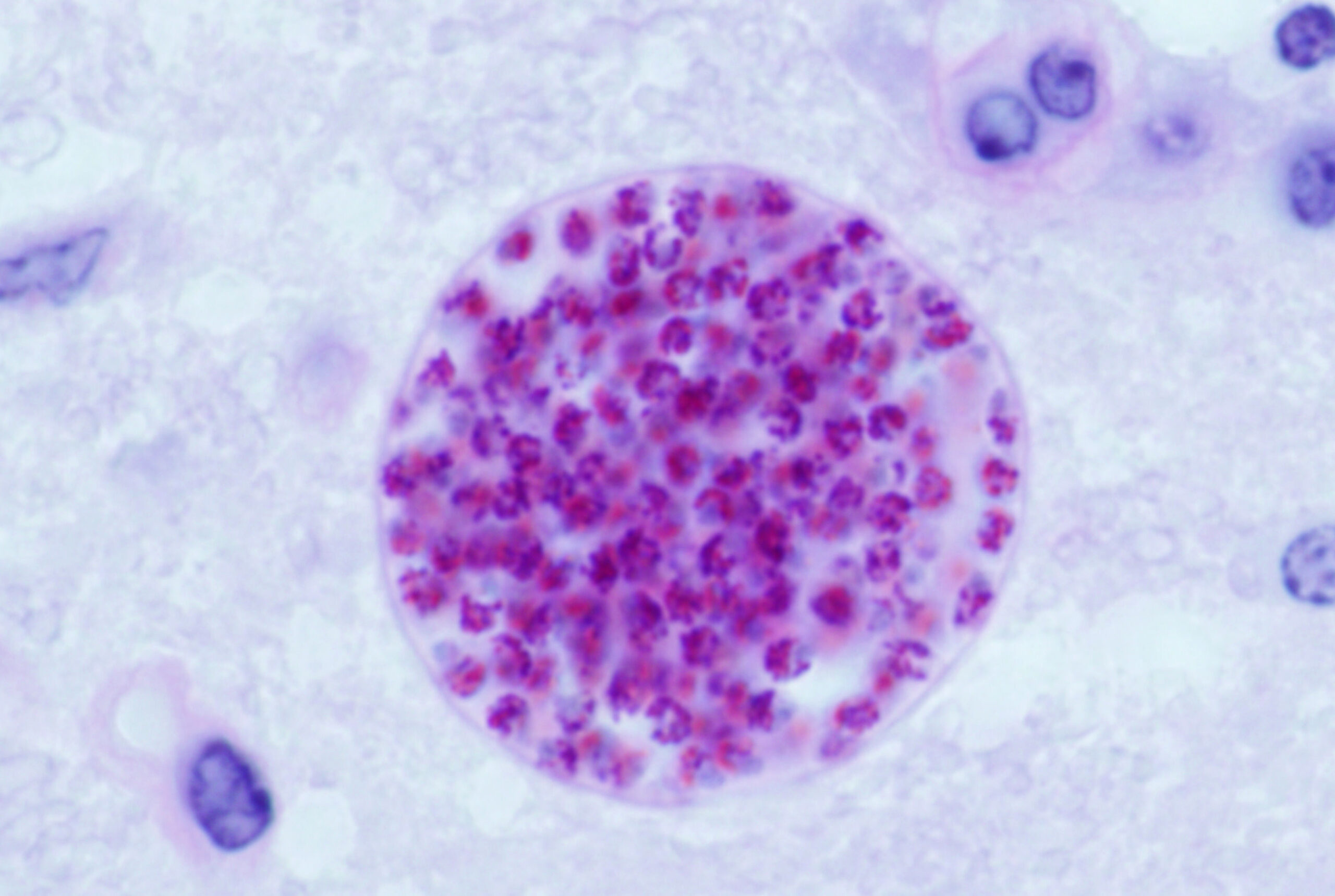 Toxoplasma gondii brain cyst