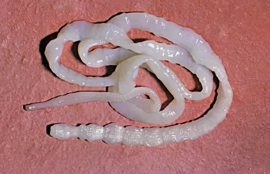 tapeworm cancer in humans