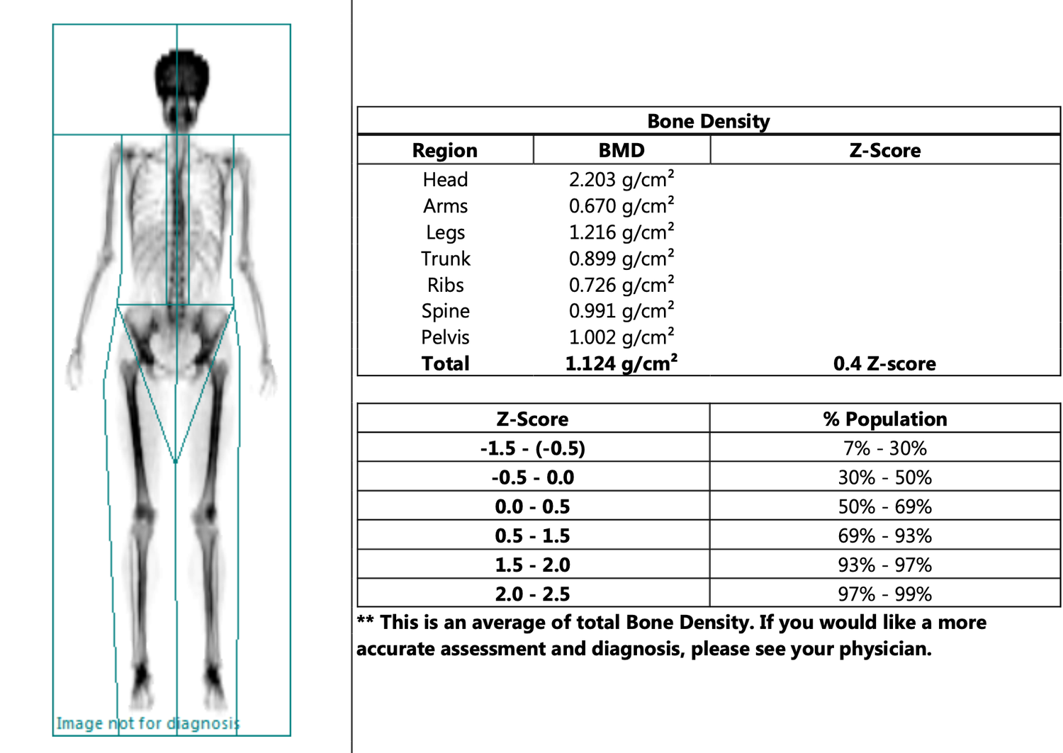 My experience with a DEXA Scan! What is it, and is it worth it? — Whole Body Health Physical Therapy Portland. Oregon