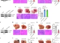 SLC38A4 expression was confirmed by western blot in multiple tumor cell lines. In mouse models, liver tissue imaging (H&E staining) showed that overexpression of SLC38A4 reduced metastatic tumor areas, while knockdown increased them across Hepa1-6, MC38, and B16F10 cells. Results were consistent in both immunocompetent and nude mice, with statistically significant differences.