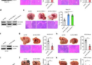 SLC38A4 expression was confirmed by western blot in multiple tumor cell lines. In mouse models, liver tissue imaging (H&E staining) showed that overexpression of SLC38A4 reduced metastatic tumor areas, while knockdown increased them across Hepa1-6, MC38, and B16F10 cells. Results were consistent in both immunocompetent and nude mice, with statistically significant differences.