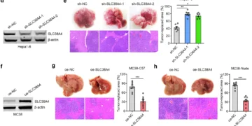 SLC38A4 expression was confirmed by western blot in multiple tumor cell lines. In mouse models, liver tissue imaging (H&E staining) showed that overexpression of SLC38A4 reduced metastatic tumor areas, while knockdown increased them across Hepa1-6, MC38, and B16F10 cells. Results were consistent in both immunocompetent and nude mice, with statistically significant differences.