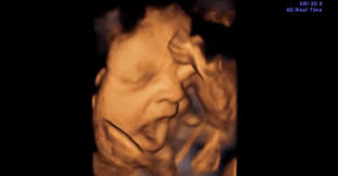 Babies Yawn in the Womb