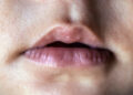 Parents Blame Lip-Ties for Nursing Struggles, But Study Highlights Maternal Experience